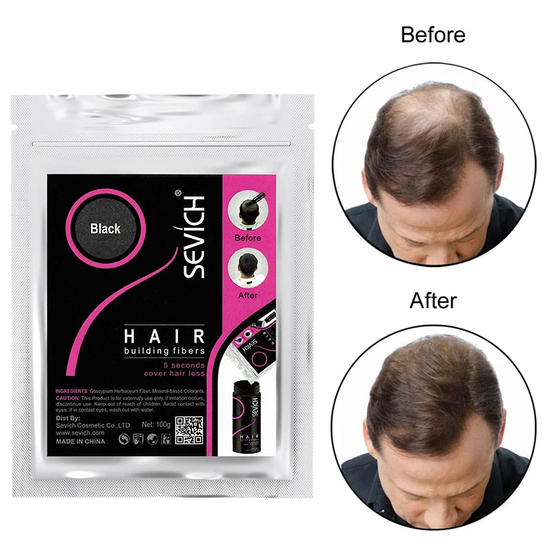 Sevich 100g Hair Fibers Refill Bag Bald Extension Hair Growth Powder